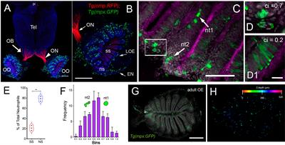 The Olfactory Organ Is a Unique Site for Neutrophils in the Brain